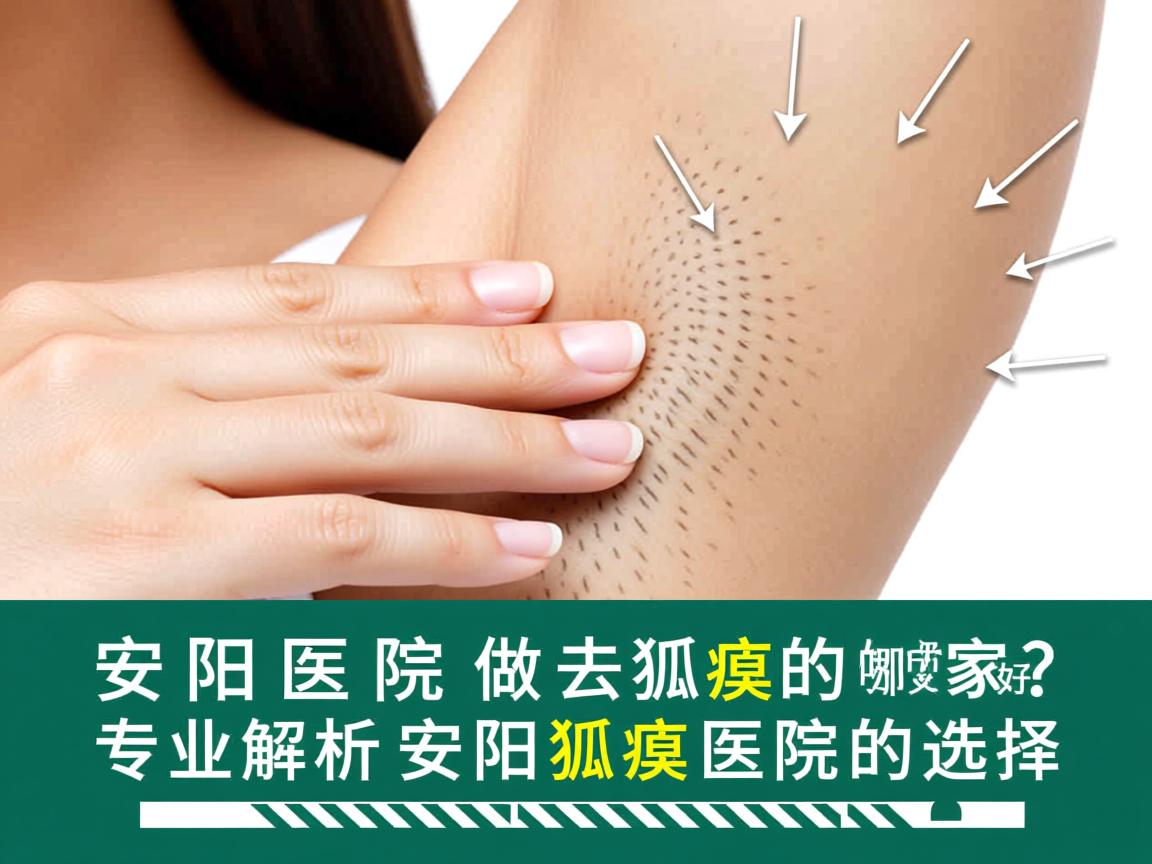 安阳医院做去狐臭的哪家好？专业解析安阳去狐臭医院的选择