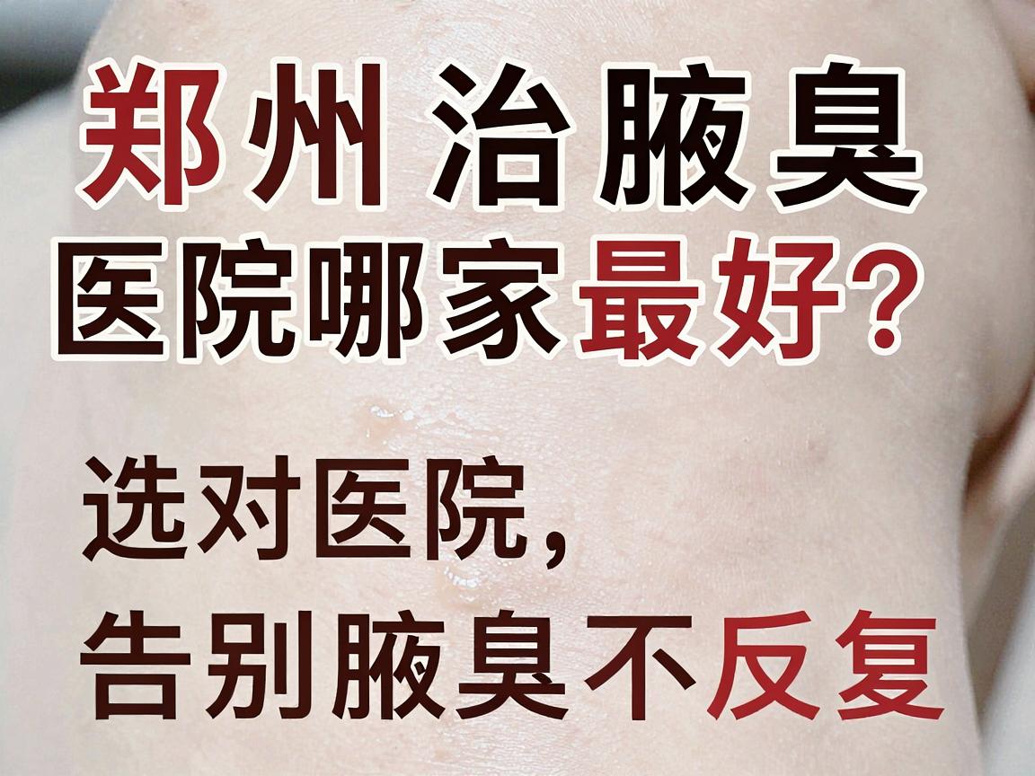 郑州治腋臭医院哪家最好？选对医院，告别腋臭不反复
