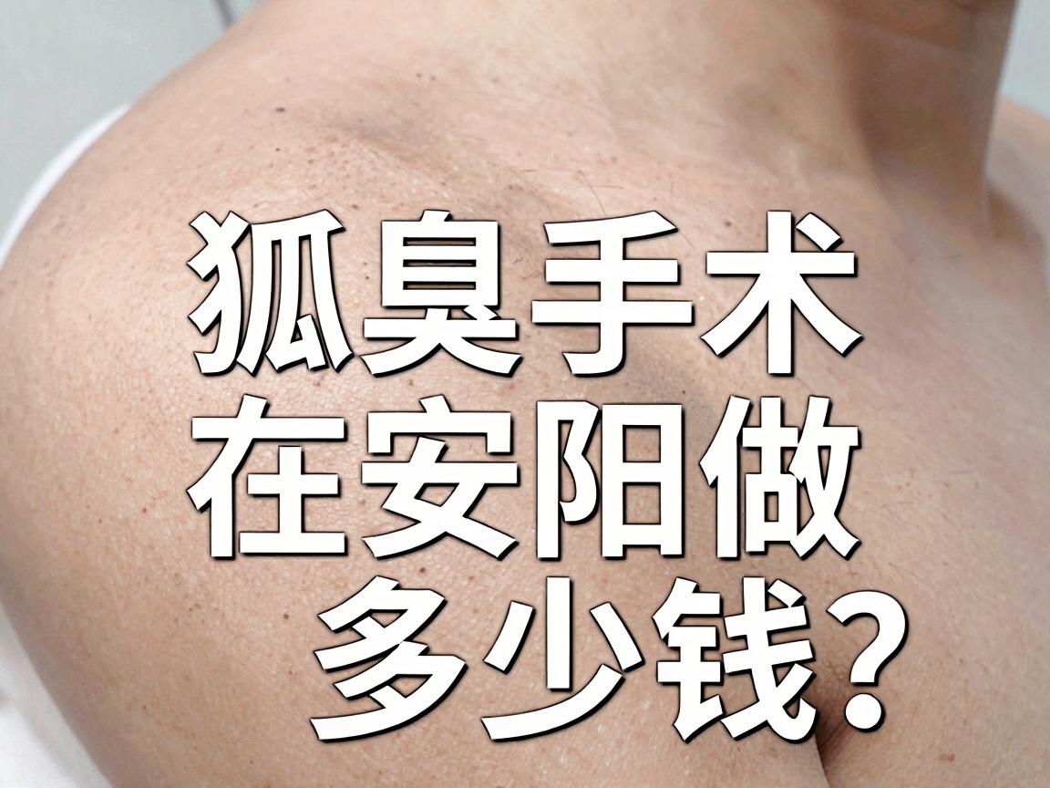 安阳狐臭手术价格大公开！狐臭手术在安阳做多少钱？这篇说透