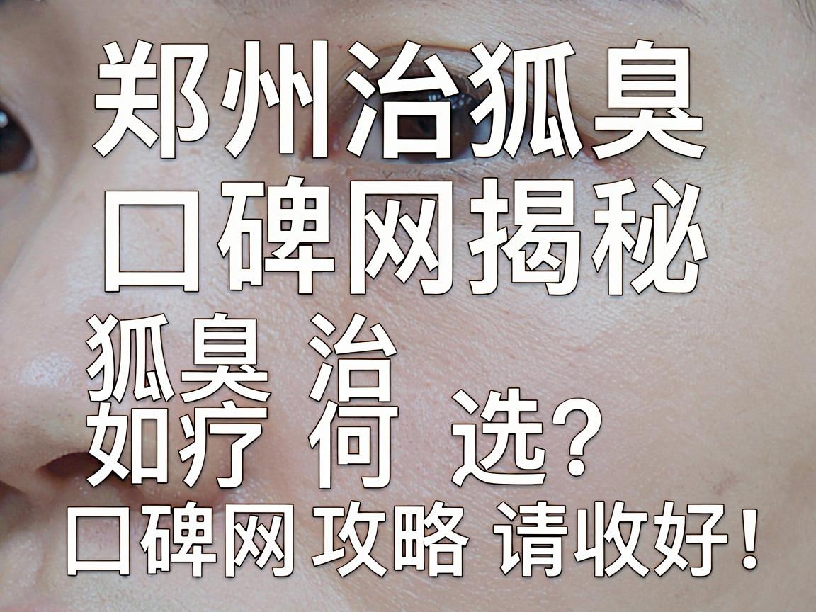 郑州治狐臭医院口碑网揭秘，狐臭治疗如何选？这份口碑网攻略请收好