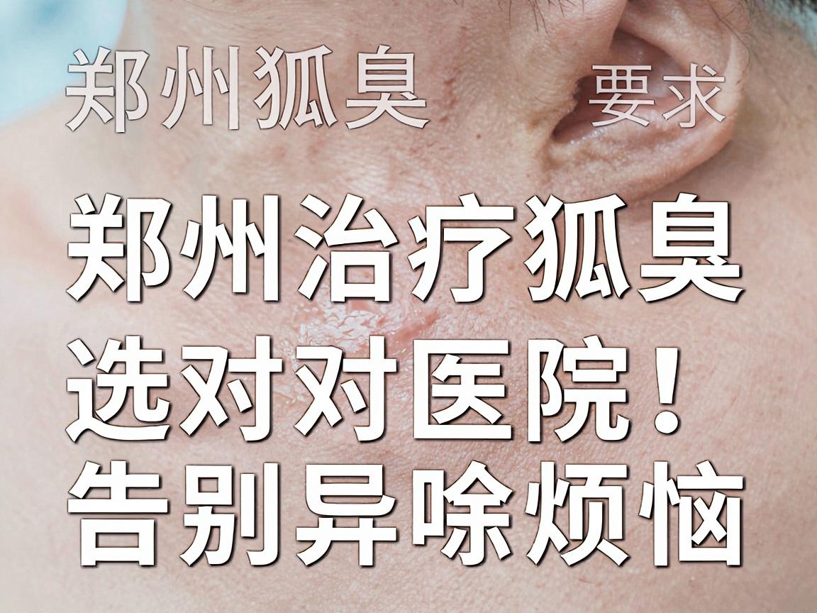 郑州治疗狐臭，选对医院，告别异味烦恼 郑州狐臭治疗医院专业解析