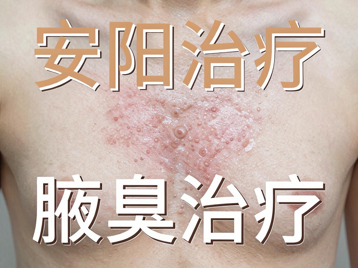 安阳腋臭治疗，安阳患者亲测有效的腋臭治疗最好方法