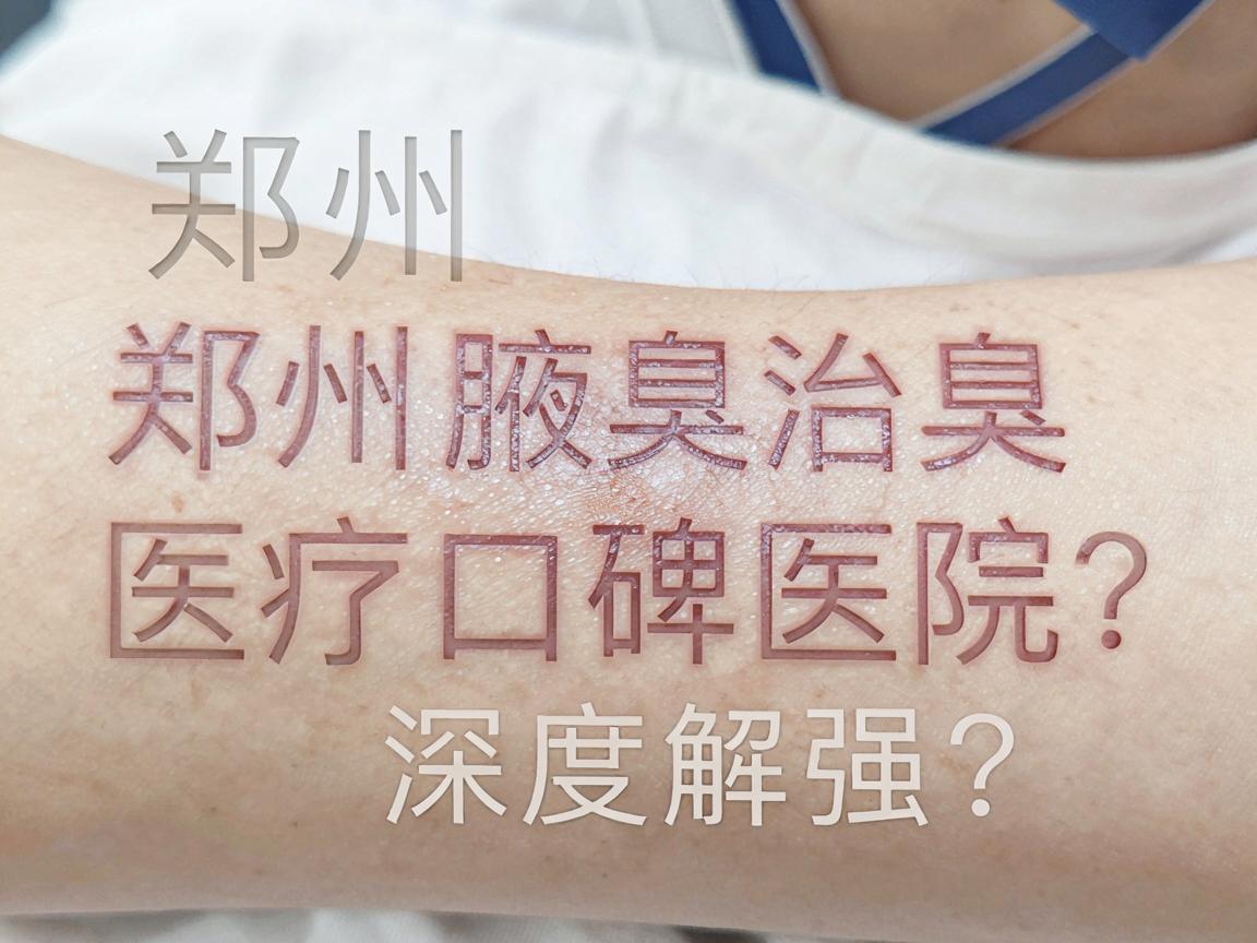 郑州治腋臭医院哪家强？郑州腋臭治疗口碑医院深度解析