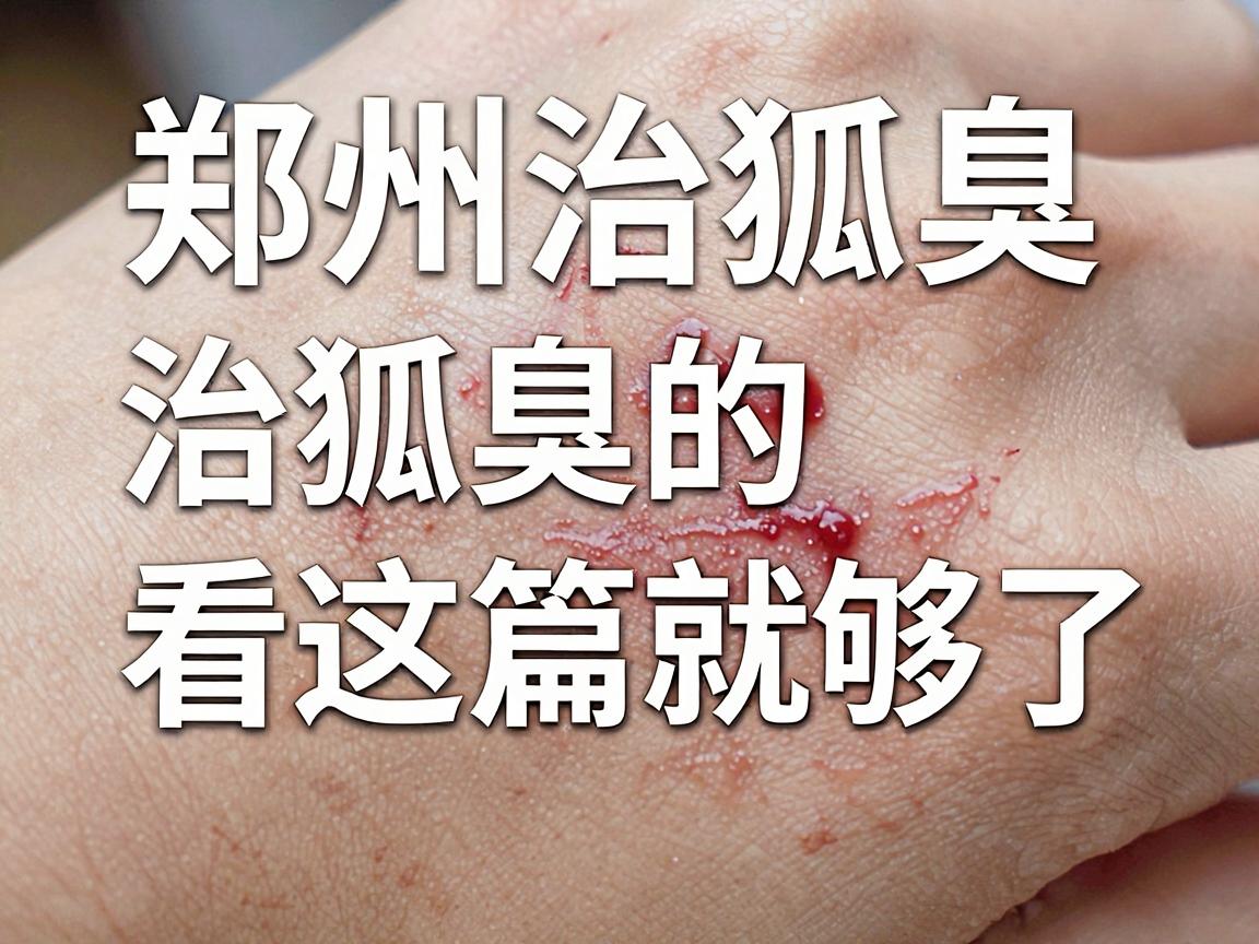郑州治狐臭医院怎么选？郑州专业治狐臭的医院看这篇就够了