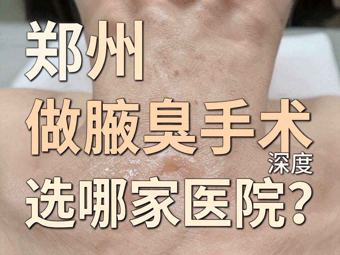 郑州做腋臭手术选哪家医院？郑州腋臭手术医院深度对比