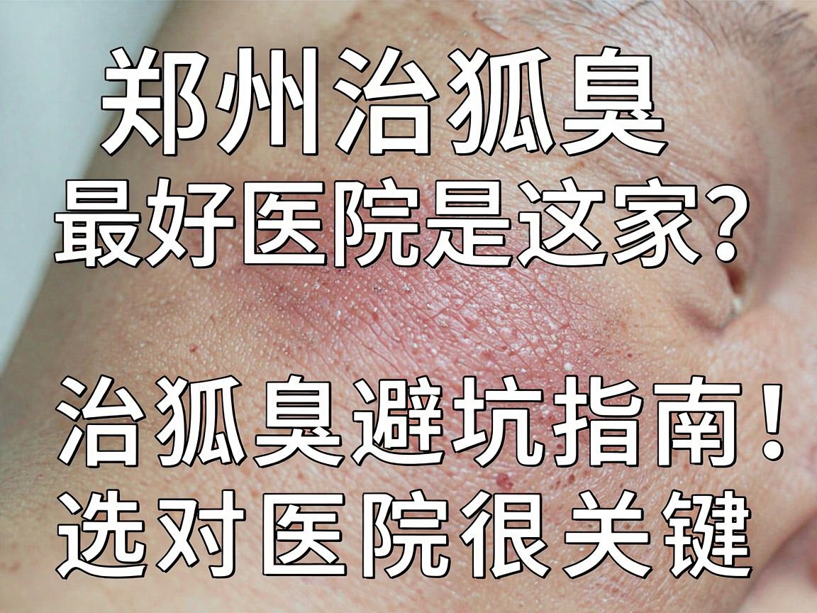 郑州治狐臭最好医院是这家？治狐臭避坑指南，选对医院很关键