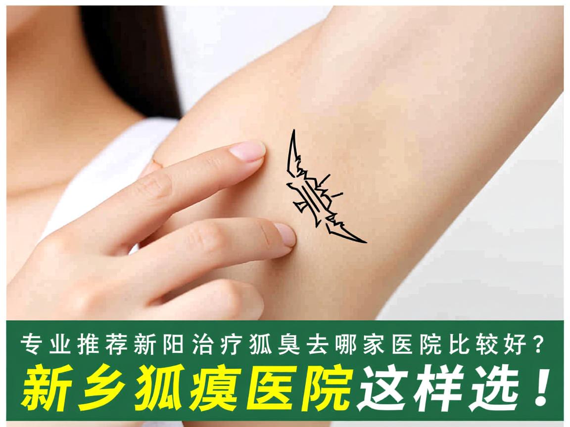 专业推荐新乡治疗狐臭去哪家医院比较好?新乡狐臭医院这样选! 专业推荐新乡治疗狐臭去哪家医院比较好?新乡狐臭医院这样选!