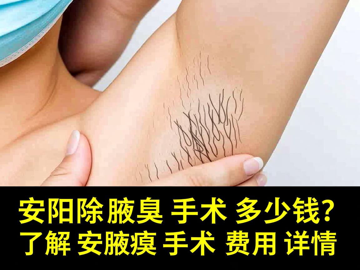 在安阳除腋臭手术多少钱?了解安阳腋臭手术费用详情 在安阳除腋臭手术多少钱?了解安阳腋臭手术费用详情