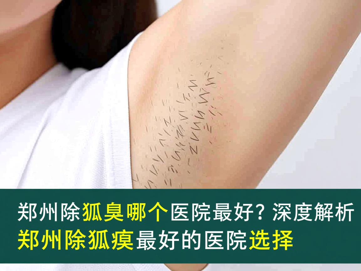 郑州除狐臭哪个医院最好？深度解析郑州除狐臭最好的医院选择