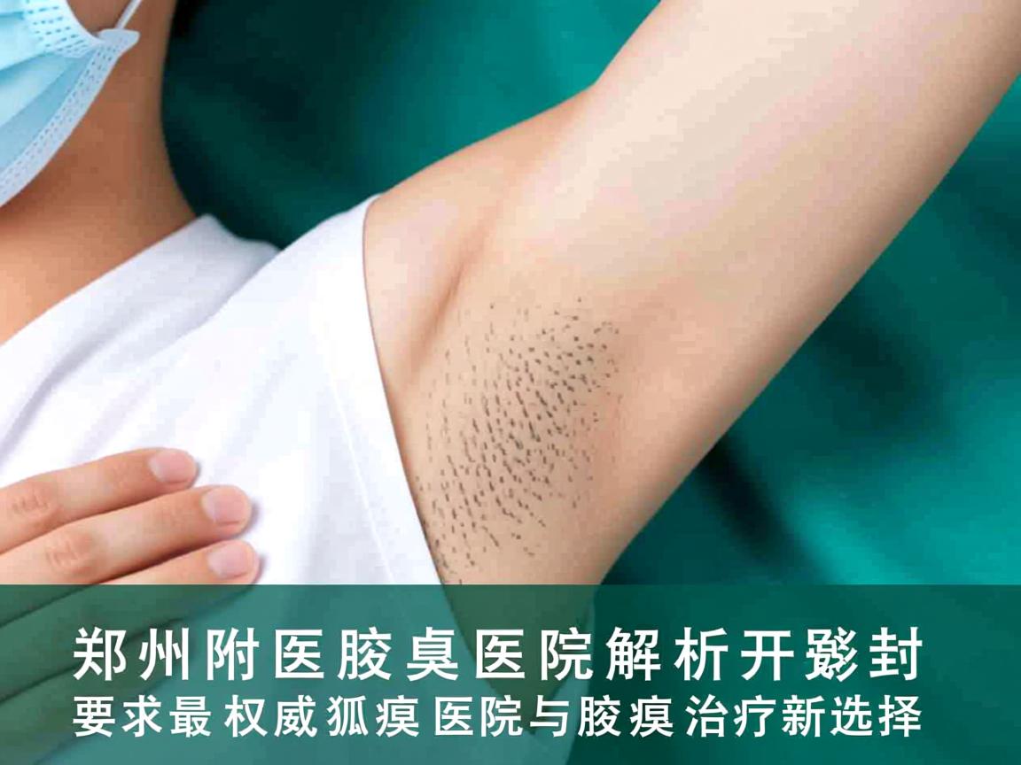 郑州附医腋臭医院解析，开封最权威狐臭医院与腋臭治疗新选择