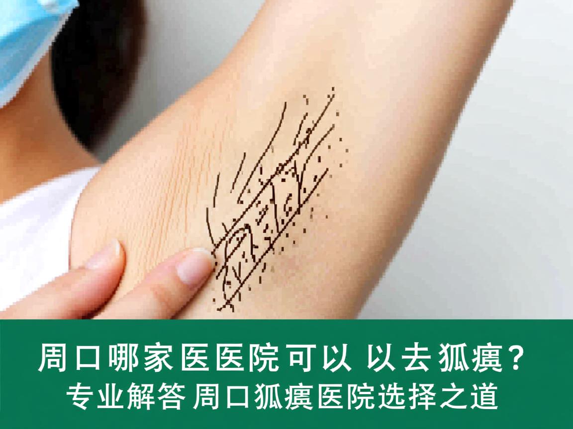 周口哪家医院可以去狐臭？专业解答周口狐臭医院选择之道