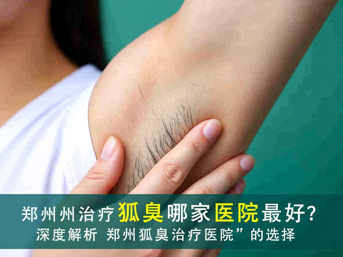 郑州治疗狐臭哪家医院最好？深度解析郑州狐臭治疗医院的选择