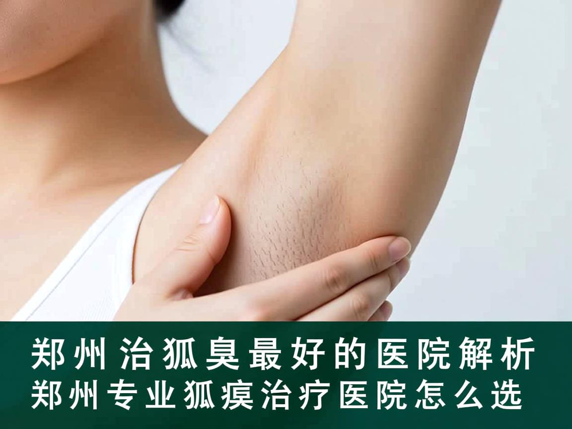 郑州治狐臭最好的医院解析，郑州专业狐臭治疗医院怎么选