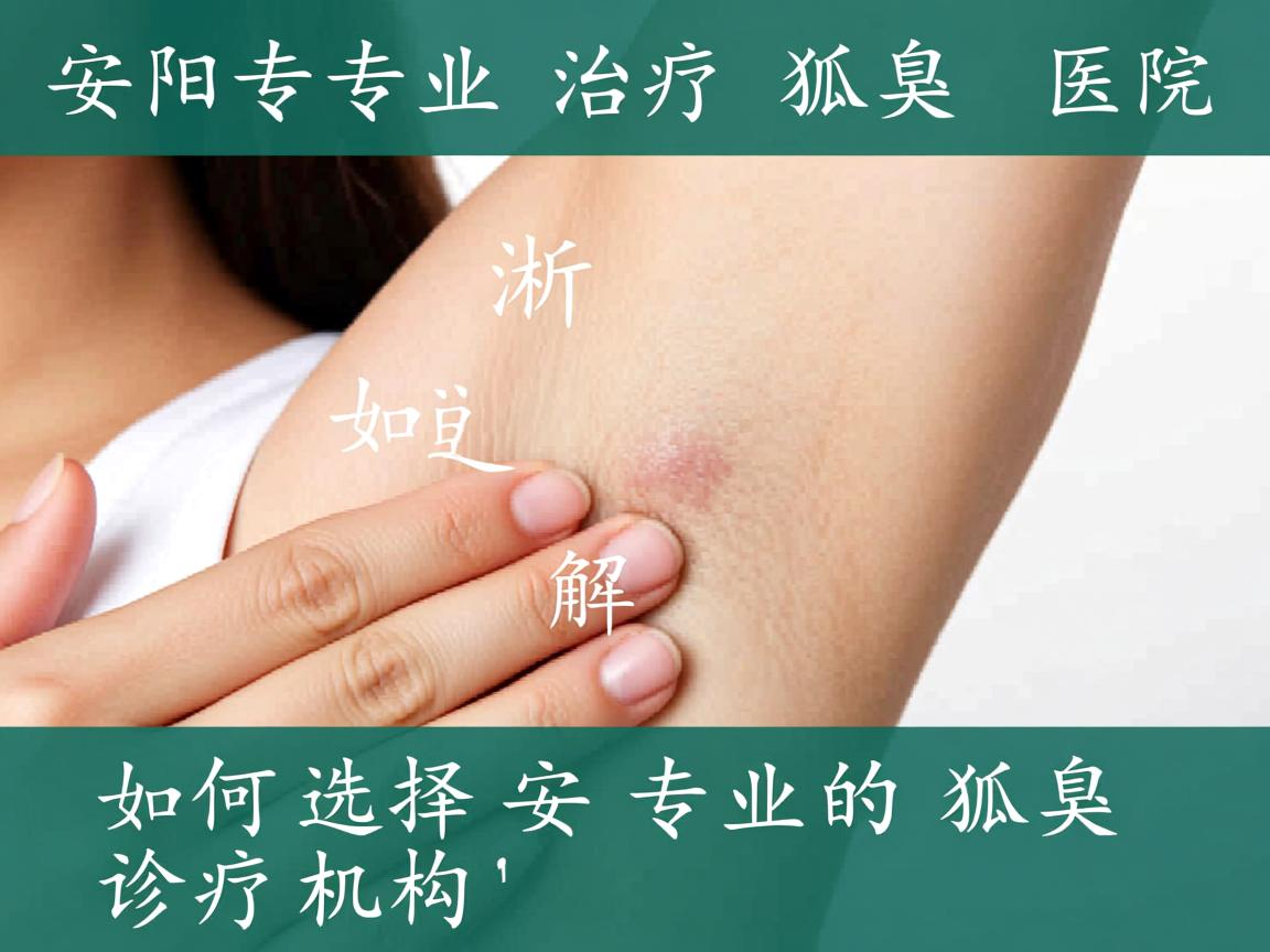 安阳专业治疗狐臭医院解析，如何选择安阳专业的狐臭诊疗机构