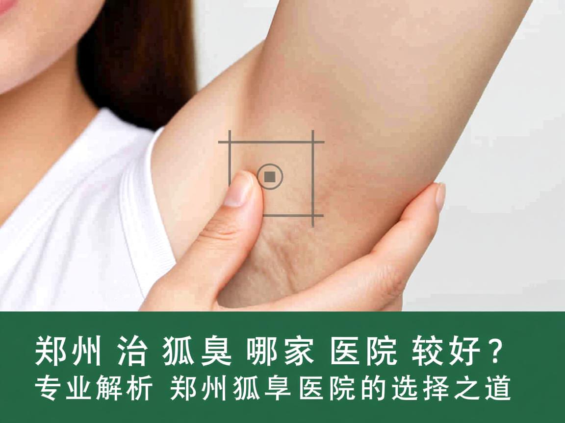 郑州治狐臭哪家医院较好？专业解析郑州狐臭医院的选择之道
