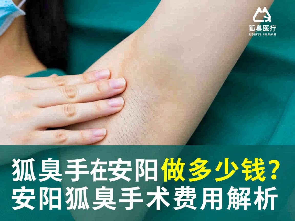 狐臭手术在安阳做多少钱？安阳狐臭手术费用解析