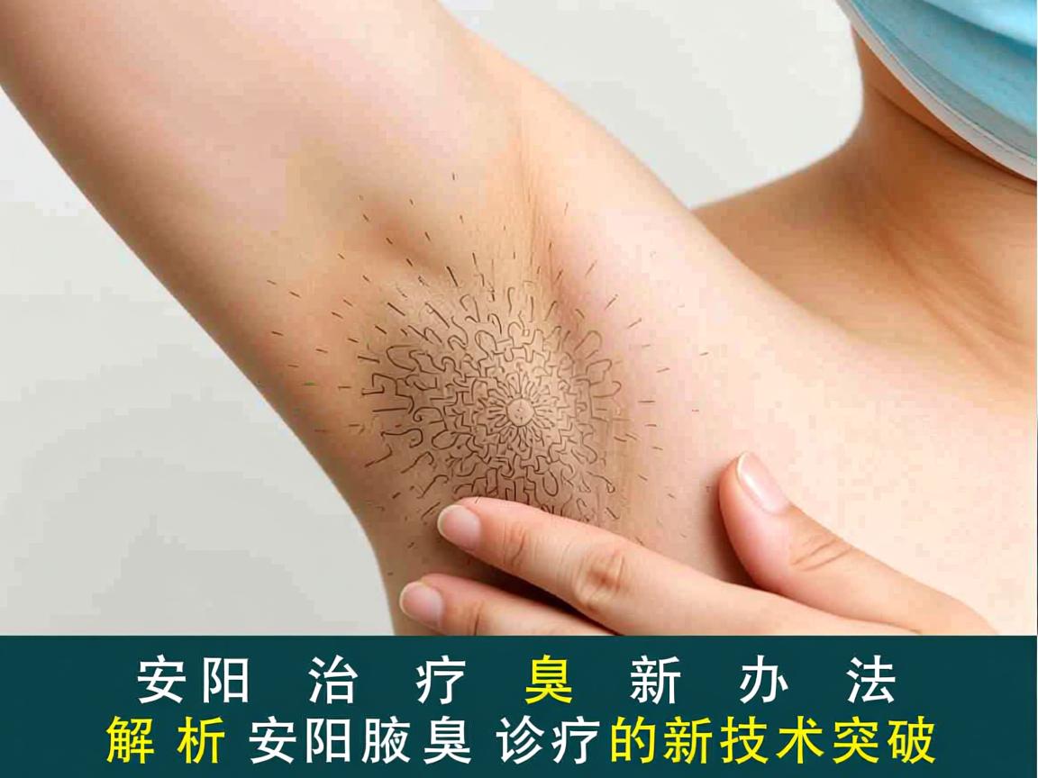 安阳治疗腋臭新办法，解析安阳腋臭诊疗的新技术突破