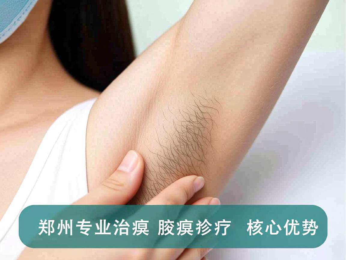 郑州专业治腋臭医院解析,郑州专业腋臭诊疗的核心优势 郑州专业治腋臭医院解析,郑州专业腋臭诊疗的核心优势