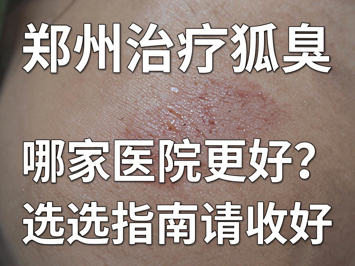 郑州治疗狐臭,哪家医院更好?这份选择指南请收好 郑州治疗狐臭,哪家医院更好?这份选择指南请收好