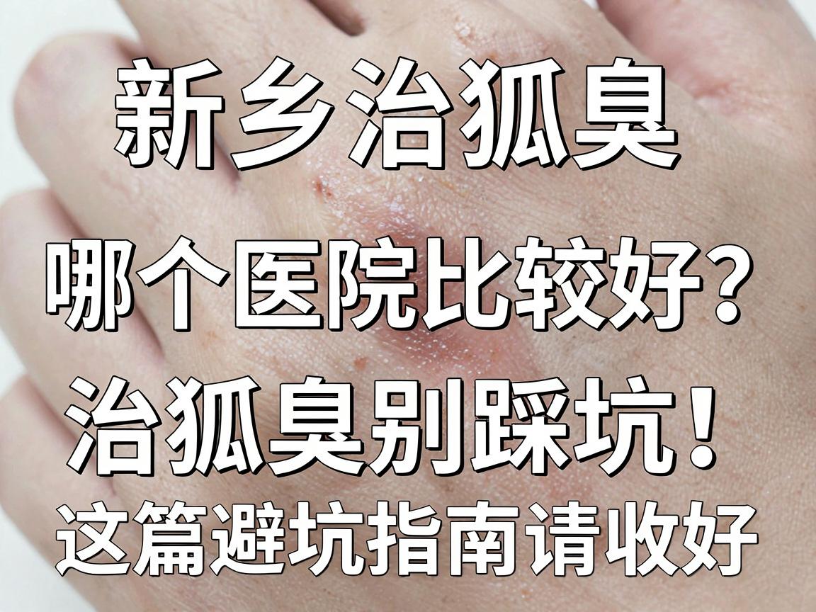新乡治狐臭哪个医院比较好？治狐臭别踩坑，这篇避坑指南请收好