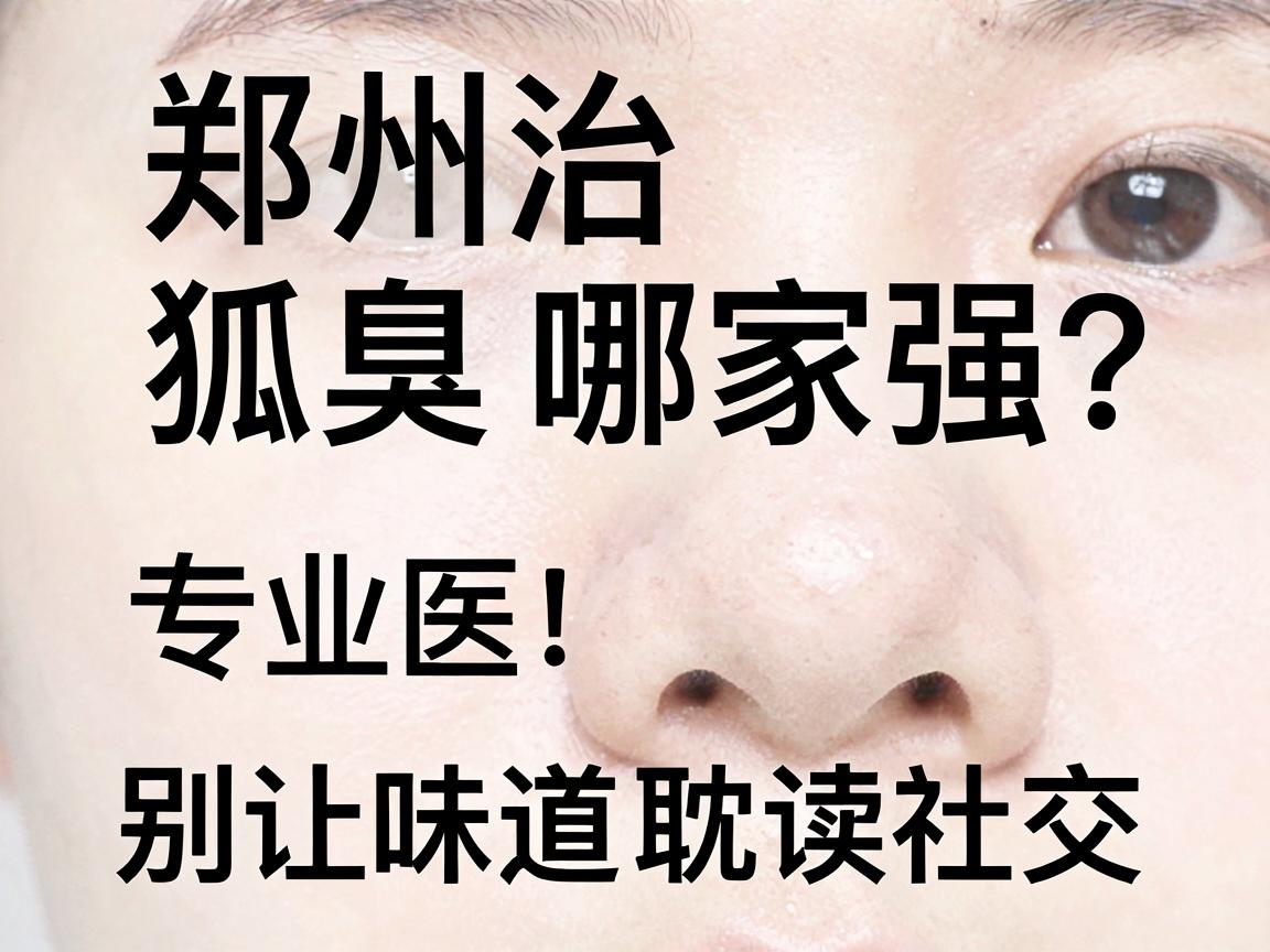 郑州治狐臭哪家强？专业医院对比，别让味道耽误社交