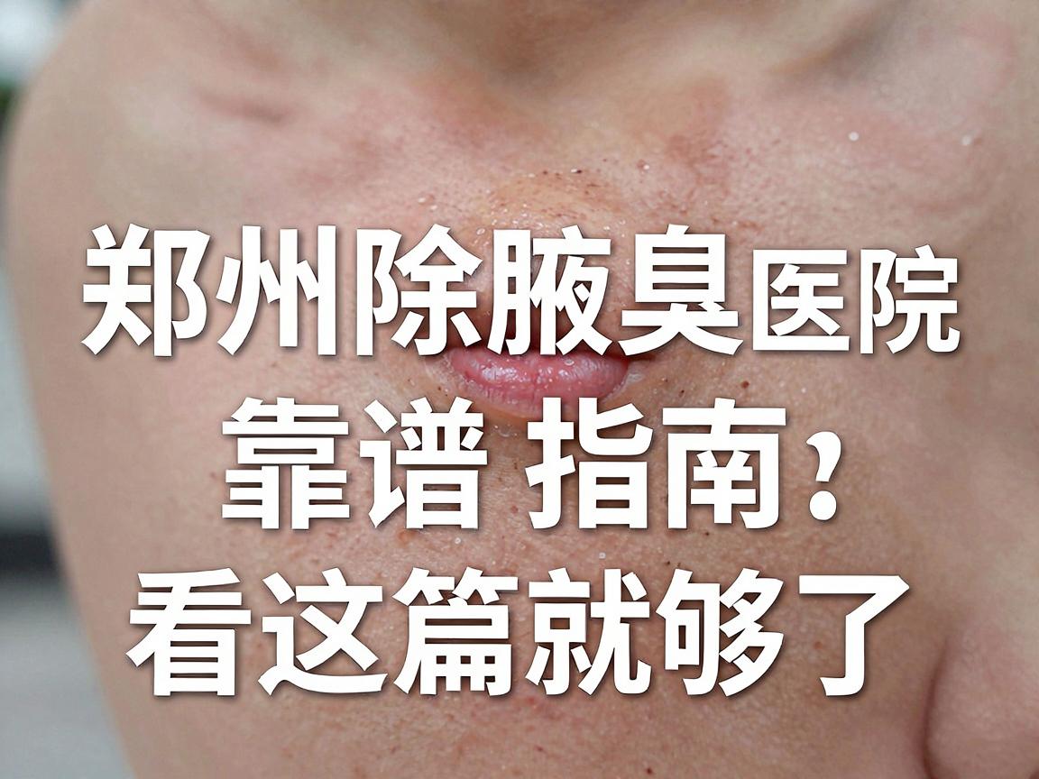 郑州除腋臭医院怎么选？郑州除腋臭医院靠谱指南，看这篇就够了