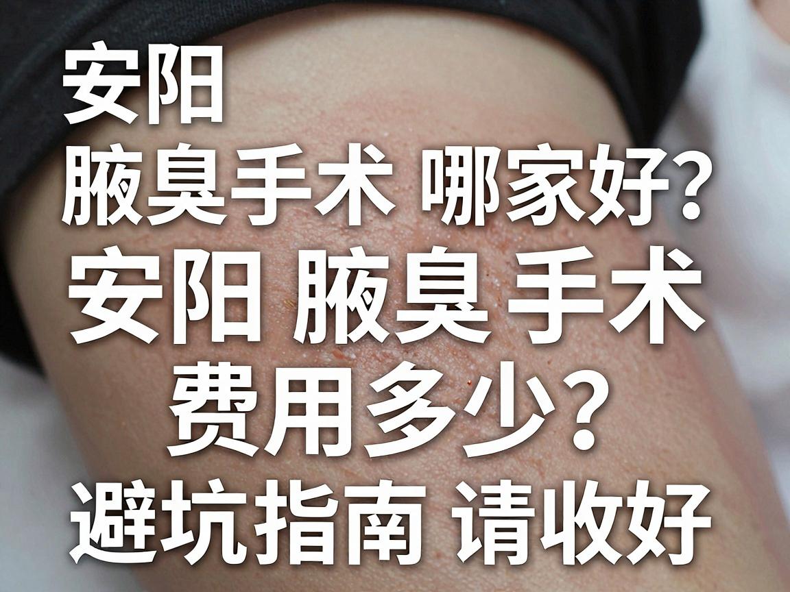 安阳腋臭手术哪家好？安阳腋臭手术费用多少？这份避坑指南请收好