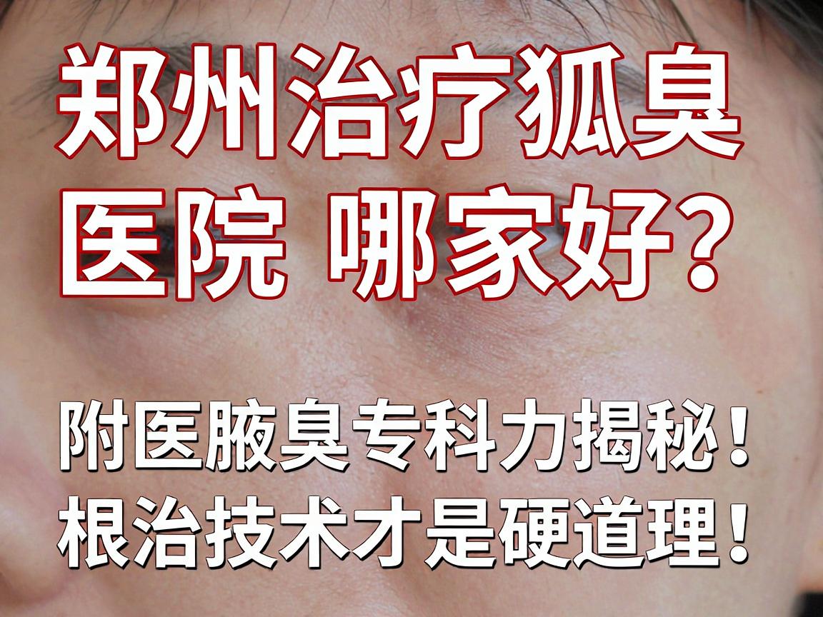 郑州治疗狐臭医院哪家好？附医腋臭专科实力揭秘，根治技术才是硬道理！