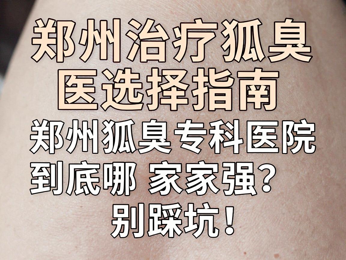 郑州治疗狐臭医院选择指南，郑州狐臭专科医院到底哪家强？别踩坑！