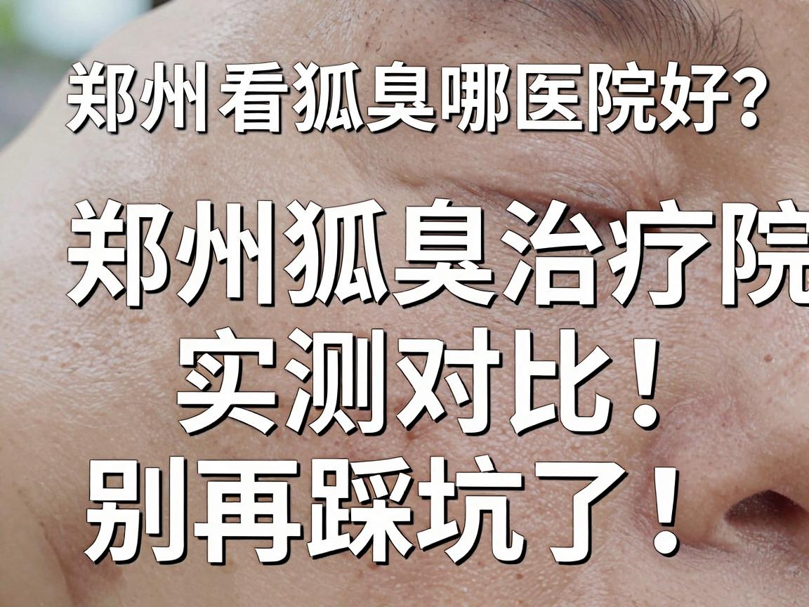 郑州看狐臭哪家医院好？郑州狐臭治疗医院实测对比，别再踩坑了！