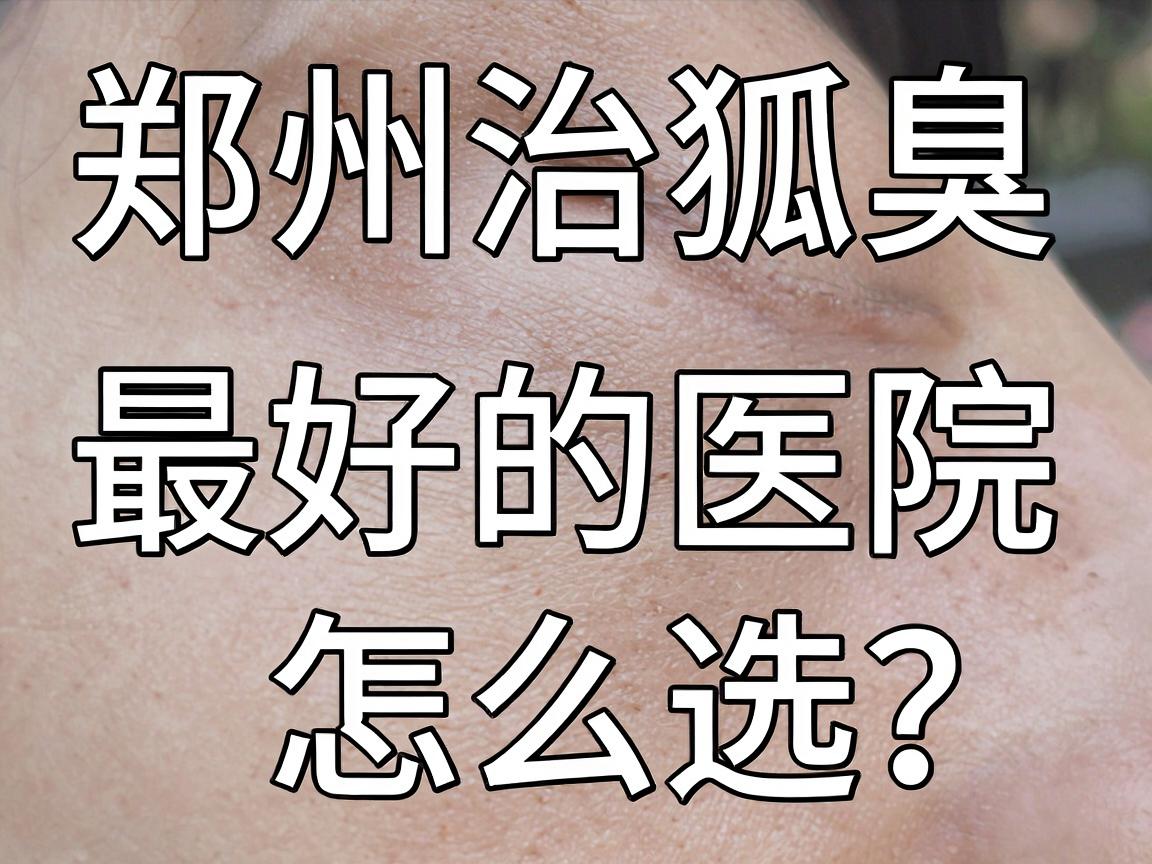 郑州治狐臭最好的医院怎么选？别再盲信广告，这篇说透郑州狐臭诊疗真相