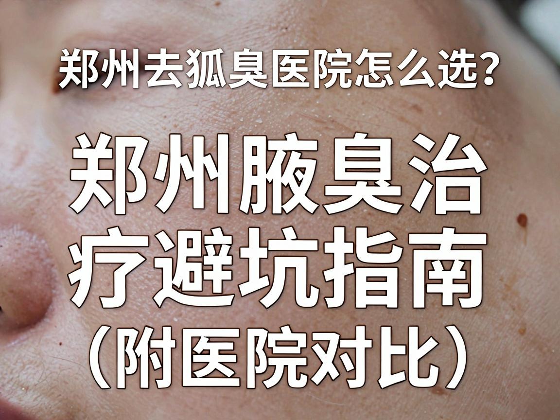 郑州去狐臭医院怎么选？郑州腋臭治疗避坑指南（附医院对比）