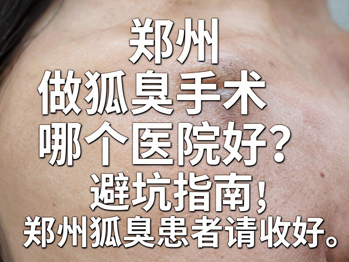 郑州做狐臭手术哪个医院好？这份避坑指南，郑州狐臭患者请收好
