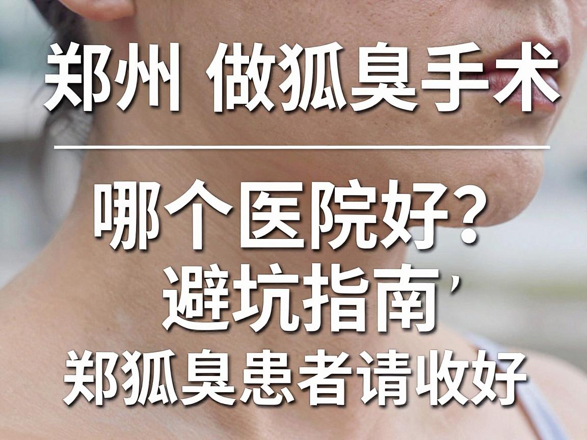 郑州做狐臭手术哪个医院好？这份避坑指南，郑州狐臭患者请收好