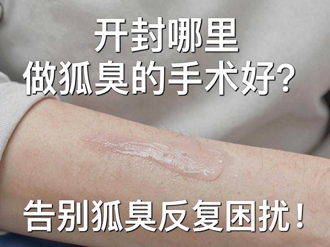 开封哪里做狐臭的手术好？选对技术，告别狐臭反复困扰！
