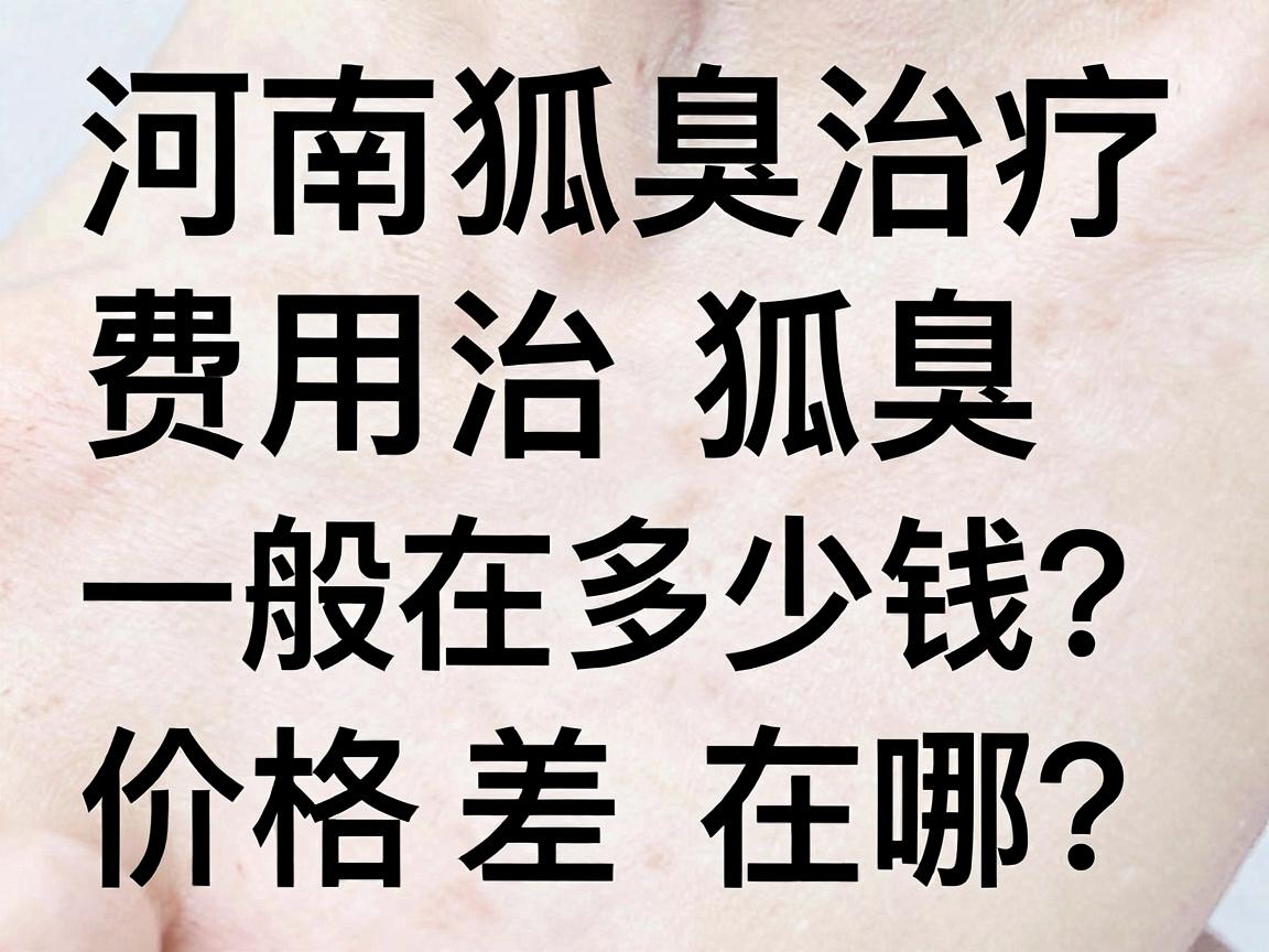 河南治狐臭一般在多少钱?价格差在哪?河南狐臭治疗费用全解析 河南治狐臭一般在多少钱?价格差在哪?河南狐臭治疗费用全解析