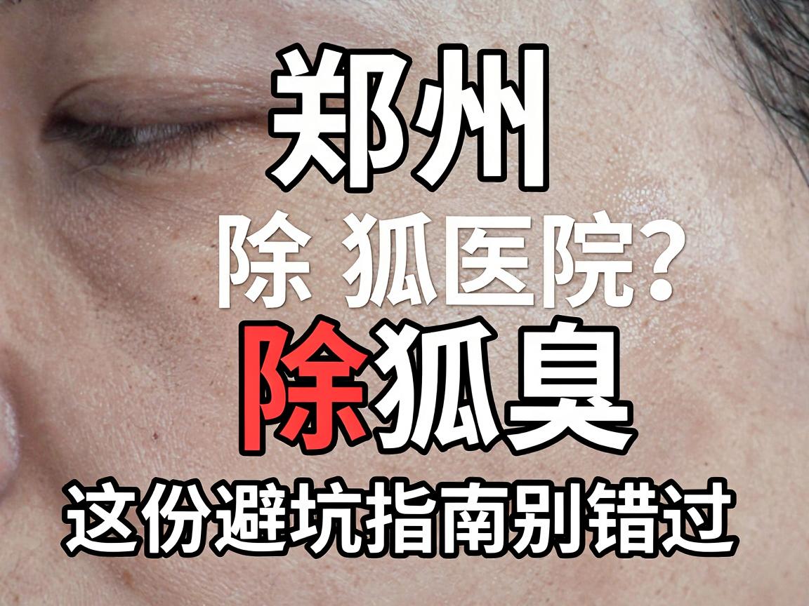 郑州除狐臭医院怎么选？正规医院除狐臭，这份避坑指南别错过