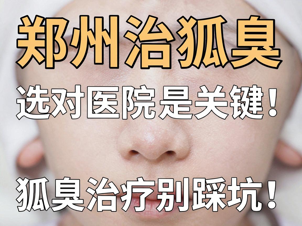郑州治狐臭，选对医院是关键！狐臭治疗别踩坑，这份郑州医院攻略请收好