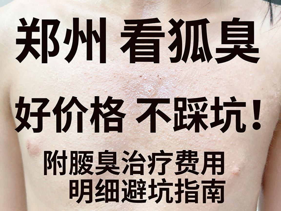 郑州看狐臭，好价格不踩坑！附腋臭治疗费用明细与避坑指南