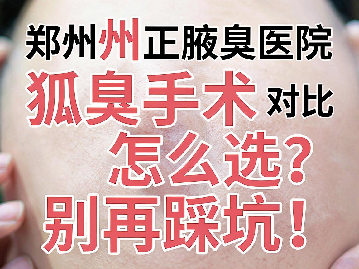 郑州狐臭手术怎么选?别再踩坑!郑州正规腋臭医院手术对比与避坑指南 郑州狐臭手术怎么选?别再踩坑!郑州正规腋臭医院手术对比与避坑指南