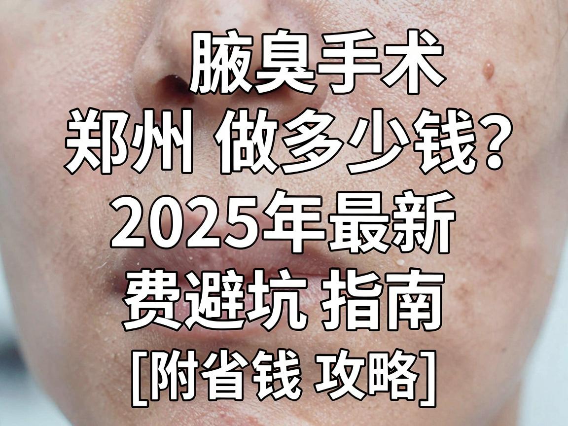 腋臭手术在郑州做多少钱？2025年最新费用明细与避坑指南（附省钱攻略）