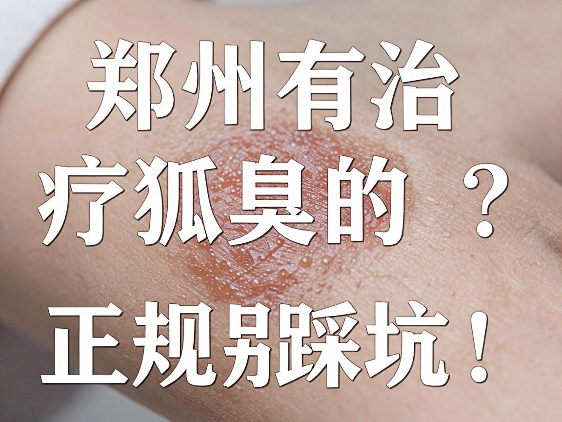 郑州有治疗狐臭的正规医院吗？正规医院治狐臭，别踩坑！
