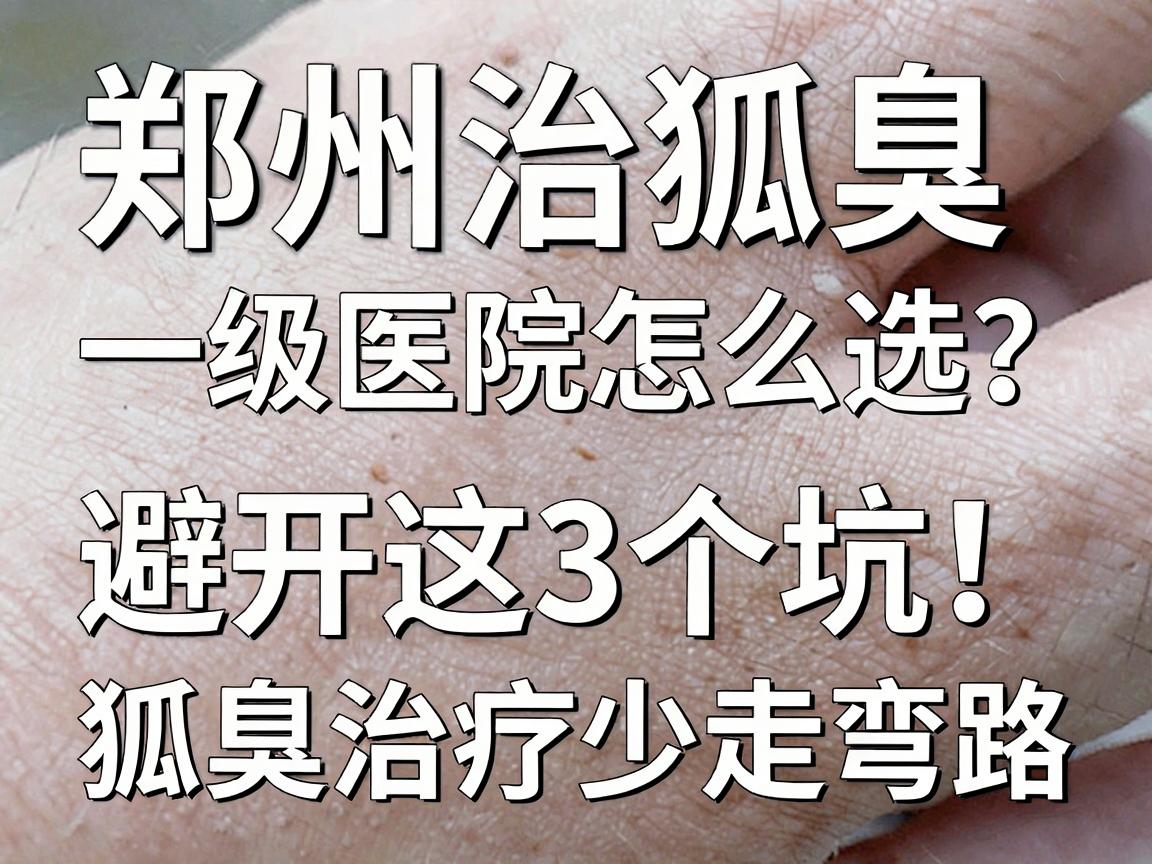 郑州治狐臭一级医院怎么选？避开这3个坑，狐臭治疗少走弯路
